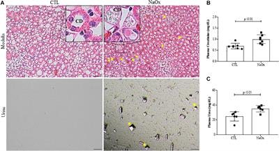Sodium Oxalate-Induced Acute Kidney Injury Associated With Glomerular and Tubulointerstitial Damage in Rats
